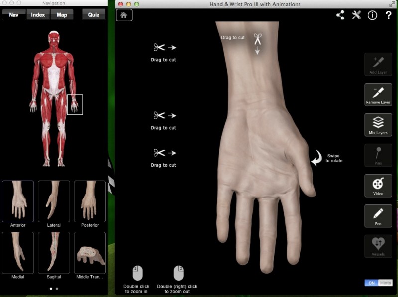 Hand & Wrist Pro III - анатомия рук человека (запястье)