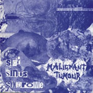 (Grindcore, Mincecore) Malignant Tumour - 14  (1996 - 2010) [MP3 (tracks), lossy]